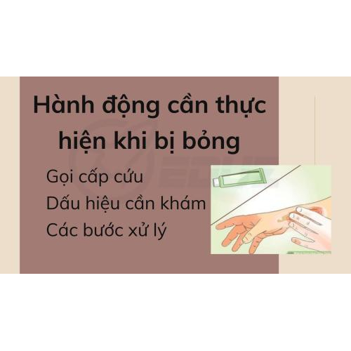 3. Hành động cần thực hiện khi bị bỏng